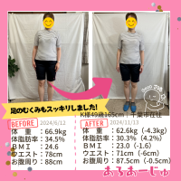 耳ツボダイエットで足のむくみとれました